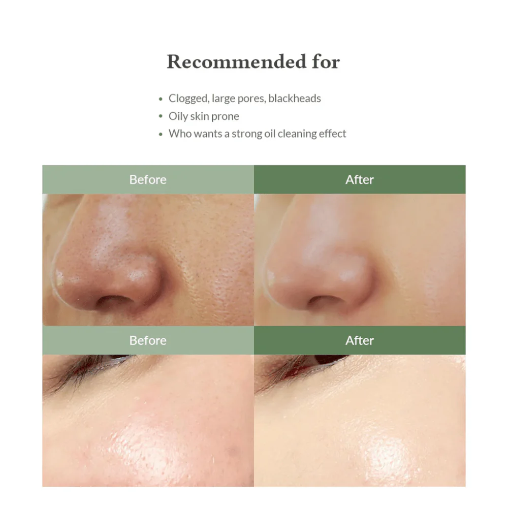 Premium Quick Step Sebum Cleanser 100ml - Image 6